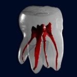 Group logo of Endodontics
